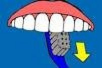 Schematische Darstellung des Putzens der Zahnrückseite der Schneidezähne