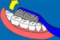 Schematische Darstellung des Putzens der Zahnrückseite